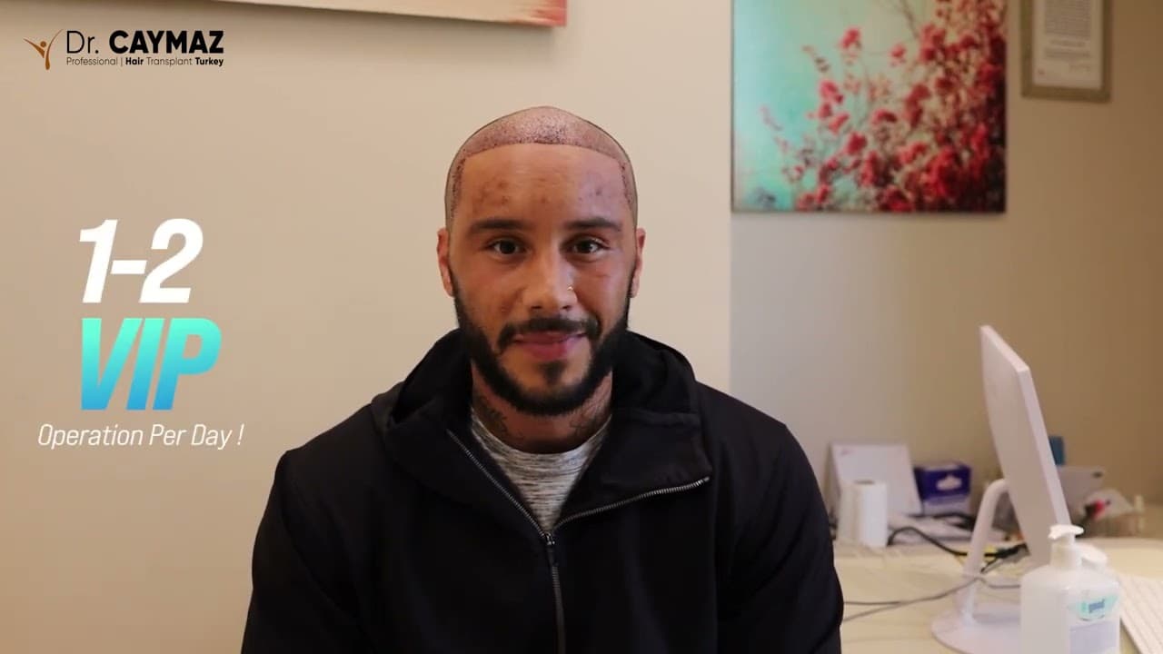 Brandyn Lemar | Sapphire FUE | 4400 Graft | USA - Hair Transplant