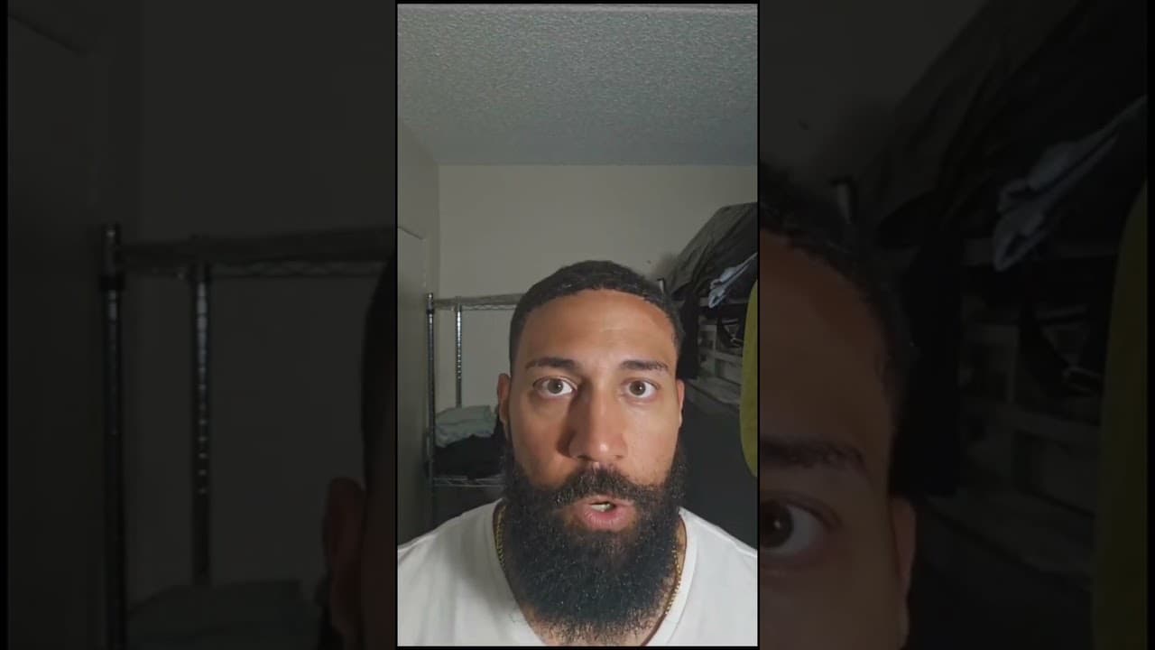 Afro Hair Transplant Result/Review