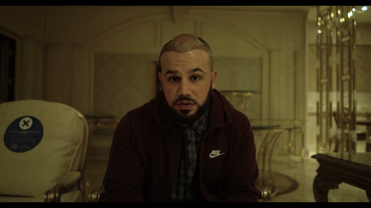 Hair Upload Hair Transplant Clinic One Day One Patient by Dr.Erkam CAYMAZ in Turkey