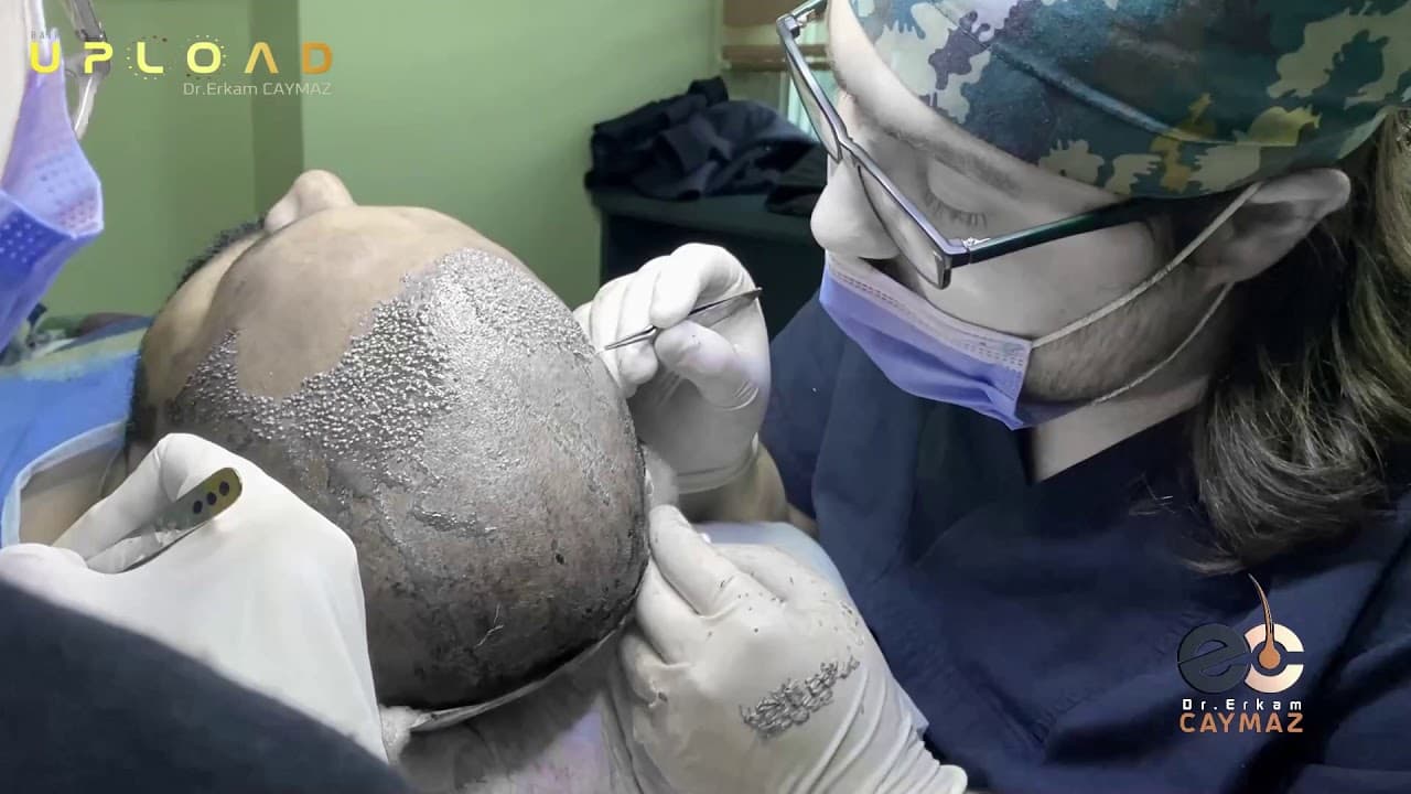 1 2 Vip Operation a Day!