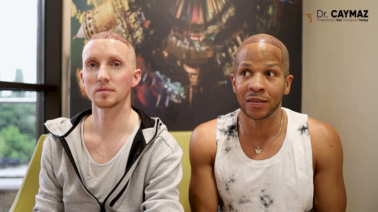 Wilbert Lee & Kurt Daniel LEE - USA-Afro American Hair Transplant Review - Sapphire Blade Incision