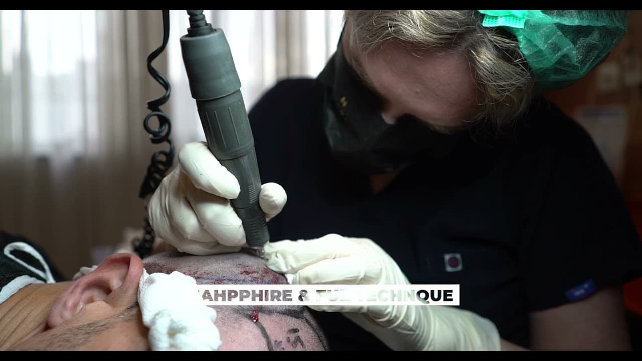 One Patient a Day by MD. Surgeon - Hair Uploading!