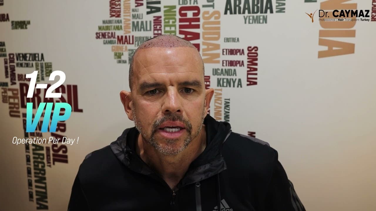 Gary MCCLAY | Sapphire FUE | 4000 Graft | USA-Hair Transplant