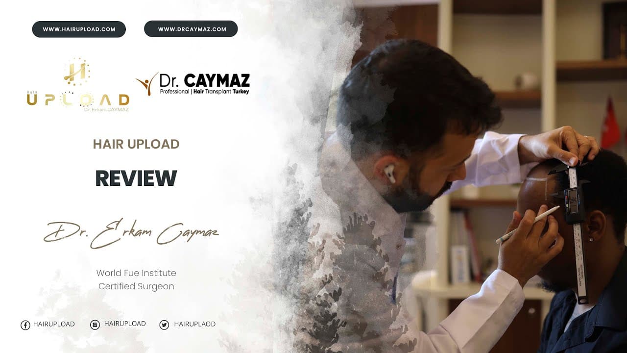 Jeramaine Shemmel Blyden | Sapphire FUE | 4000 Graft | USA - Hair Transplant