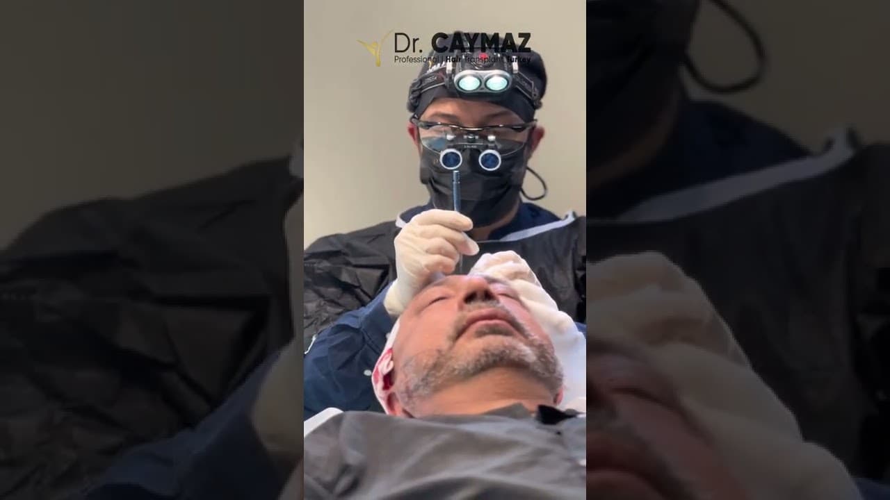 Dr Erkam CAYMAZ Vip Hair Transplantation in Turkey