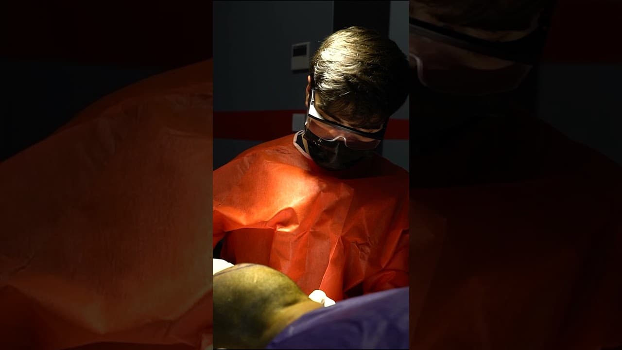 Hair Transplant in Turkey