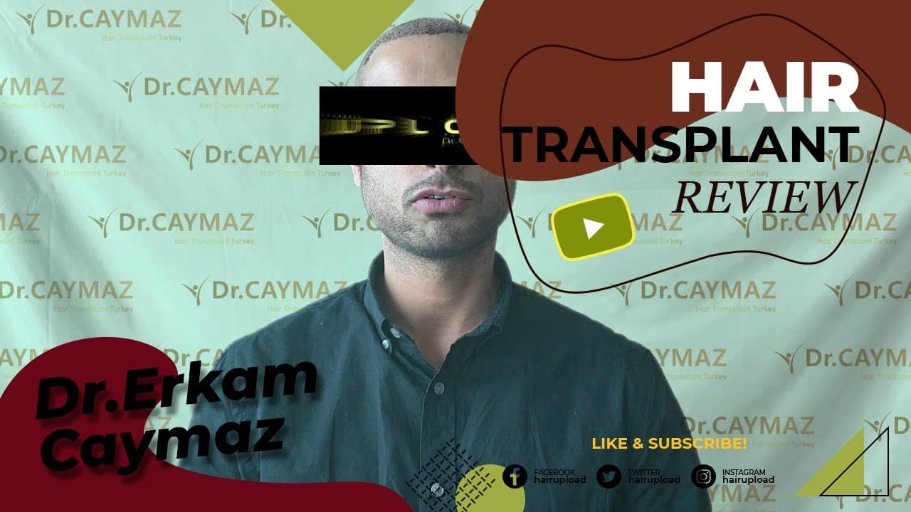 Mr.Private from Usa 4000 Graft Implanted | Hair Transplant in Istanbul Turkey | Dr.Caymaz
